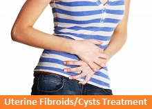 What is the treatment for ovarian fibroids?